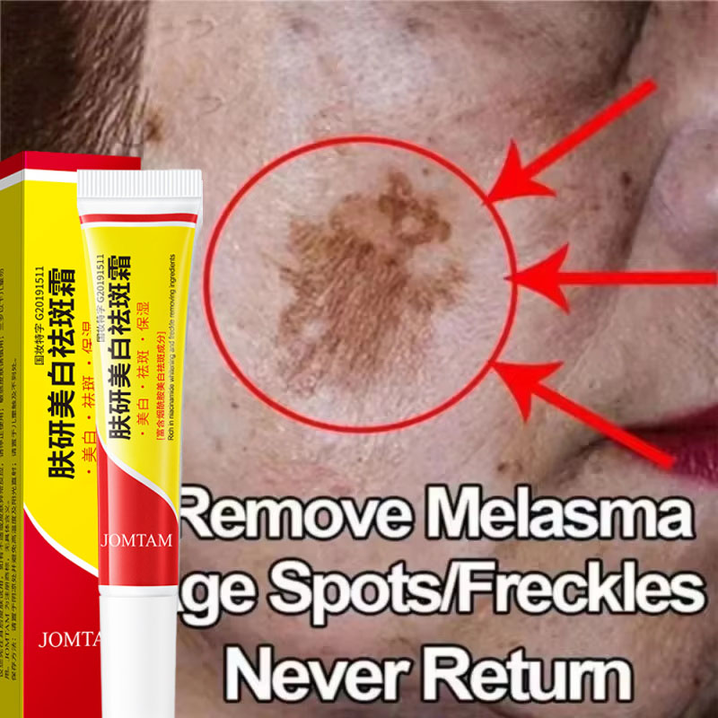Skincare Niacinamide - Crema Sbiancante Antimacchia, Crema Illuminante Viso